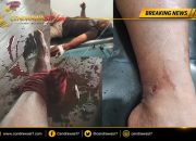 Heboh! Warga Diduga Ditembak, Korban Sebut TNI AL